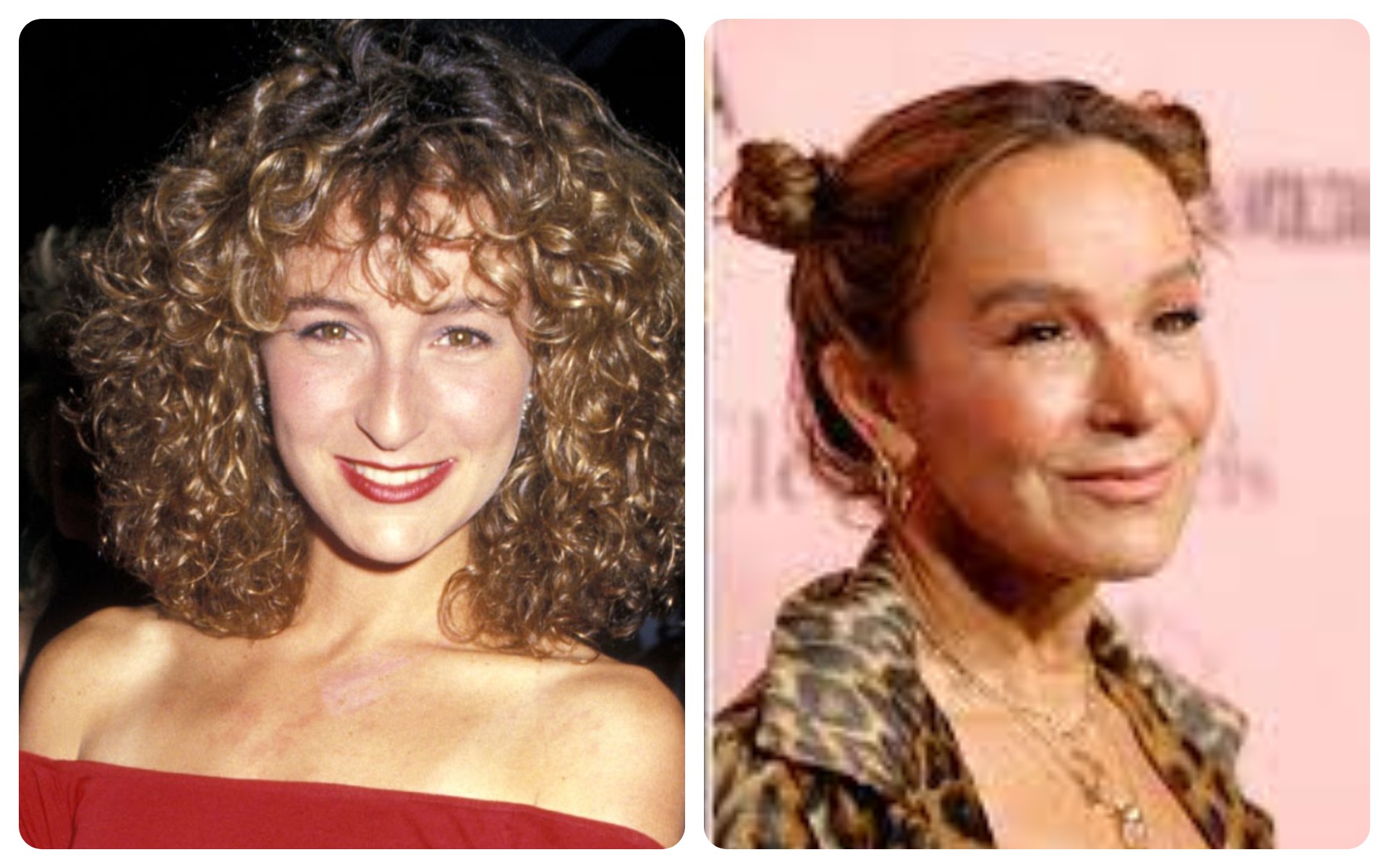 Jennifer Grey – Rhinoplasty