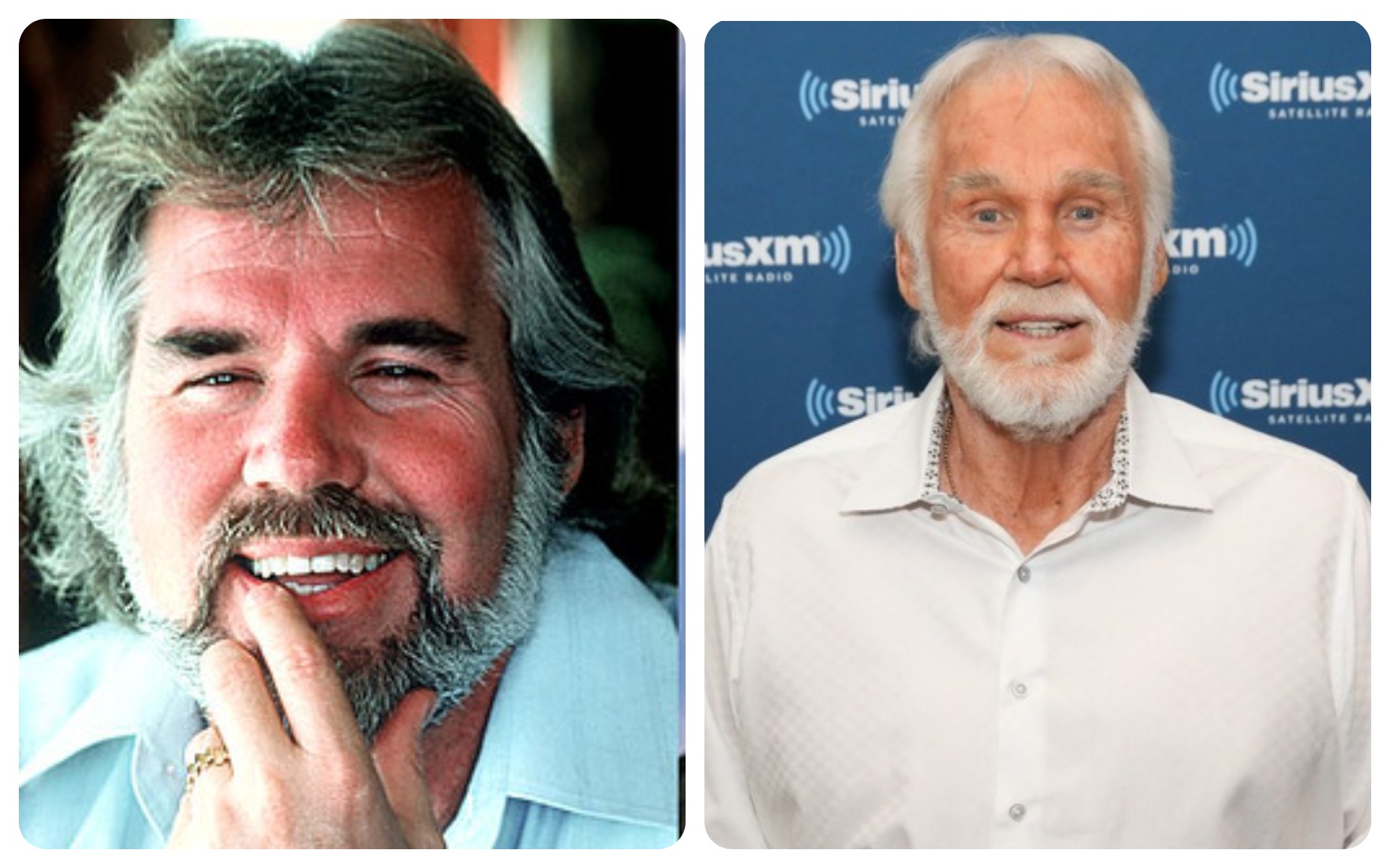 Kenny Rogers – Eyelid Surgery