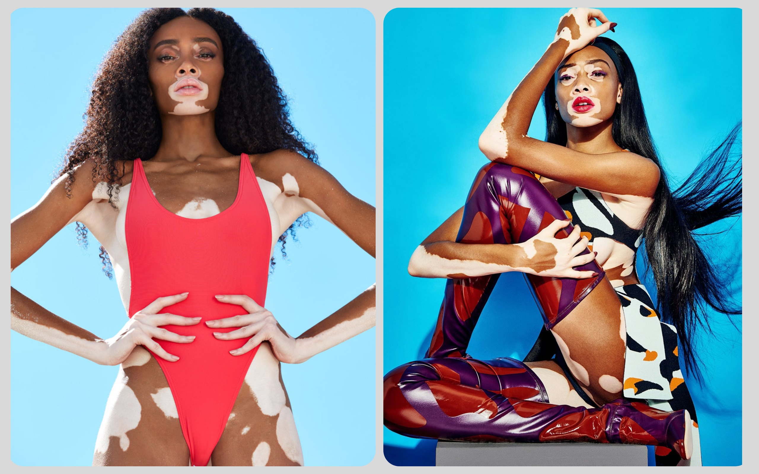 Winnie Harlow