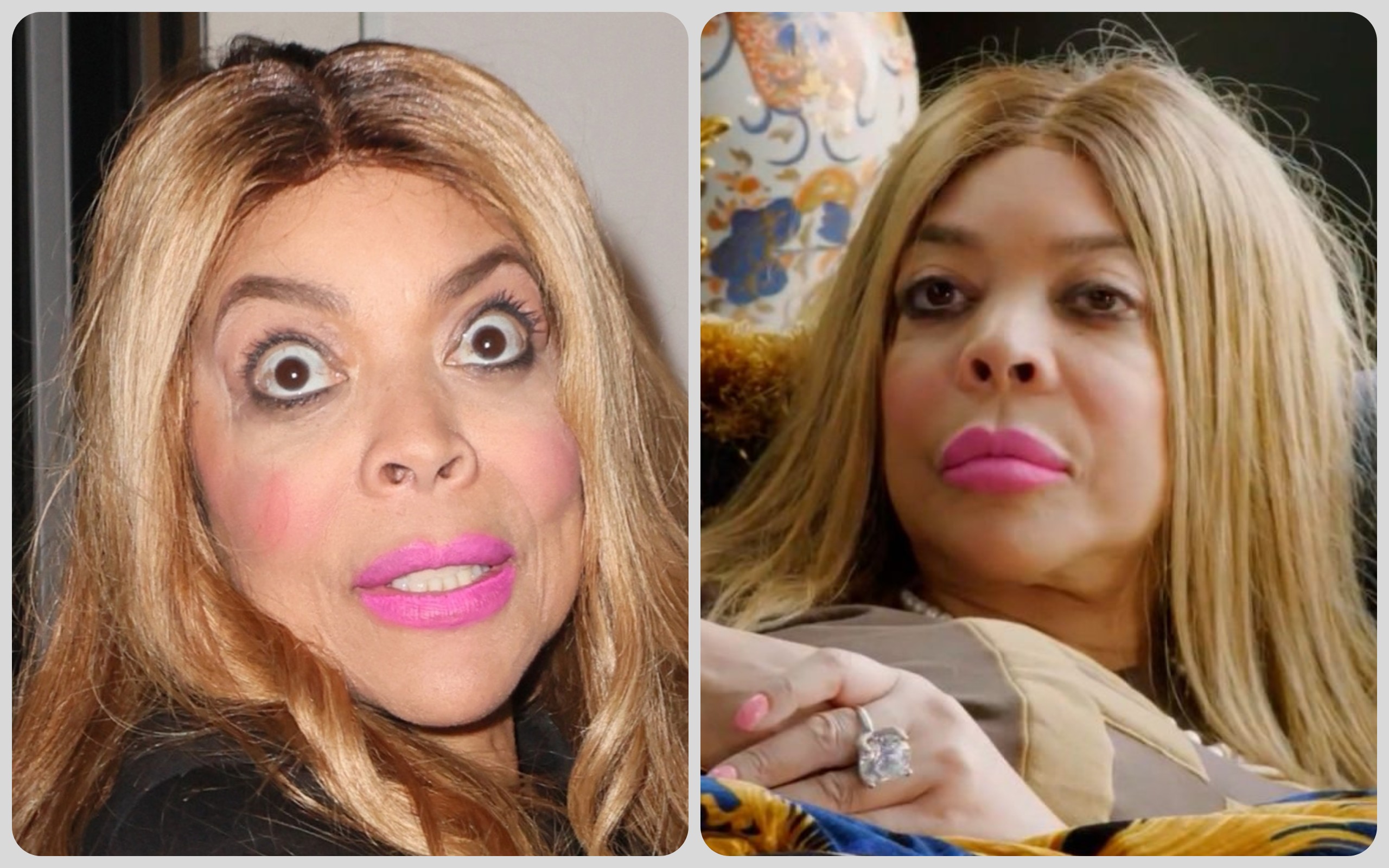 Wendy Williams’ Dementia Diagnosis 