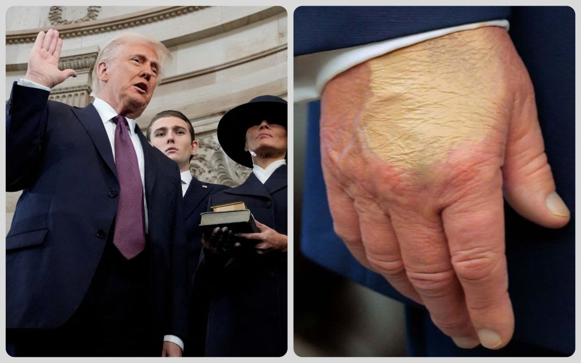 trump hand