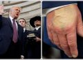 trump hand