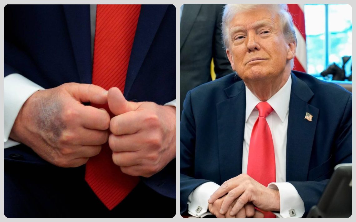 trump hands