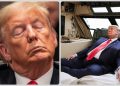 Donald Trump’s sleep
