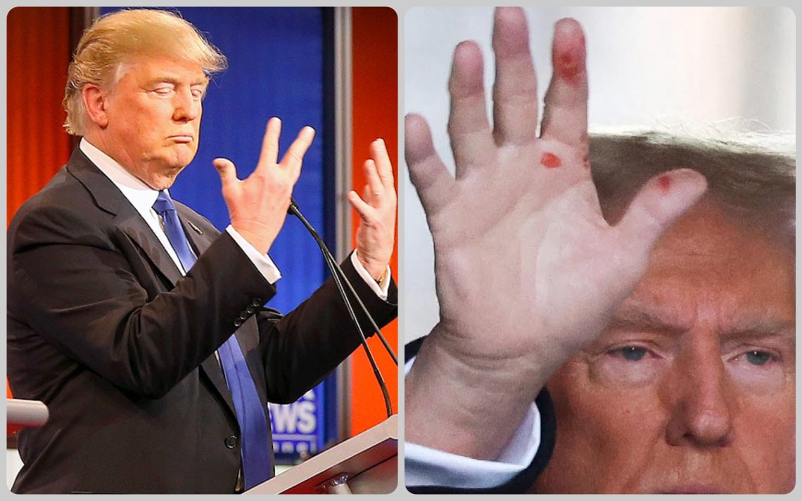 Donald Trump’s hands