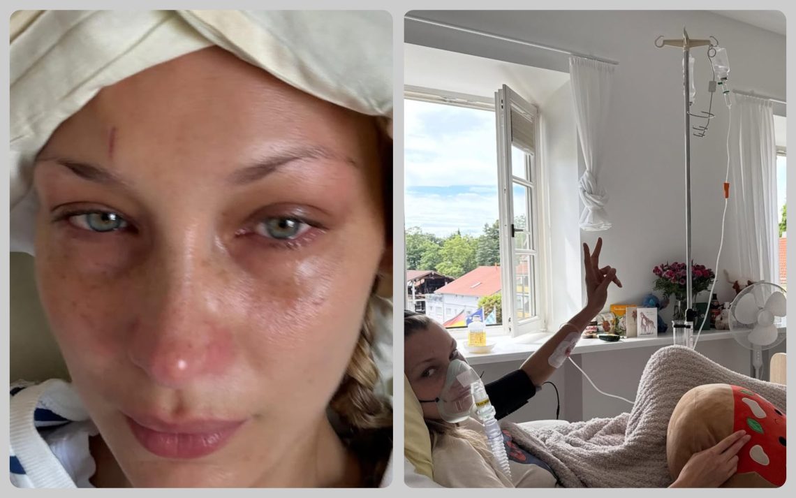Bella Hadid hospitalized