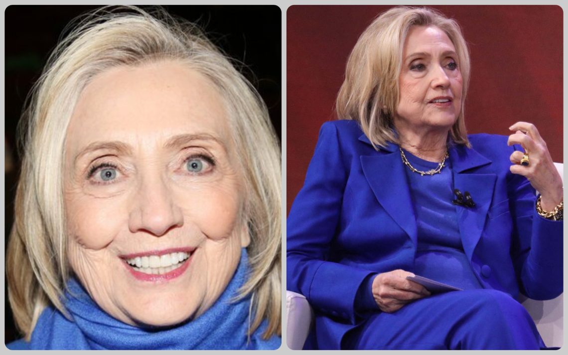 Hillary Clinton Facelift