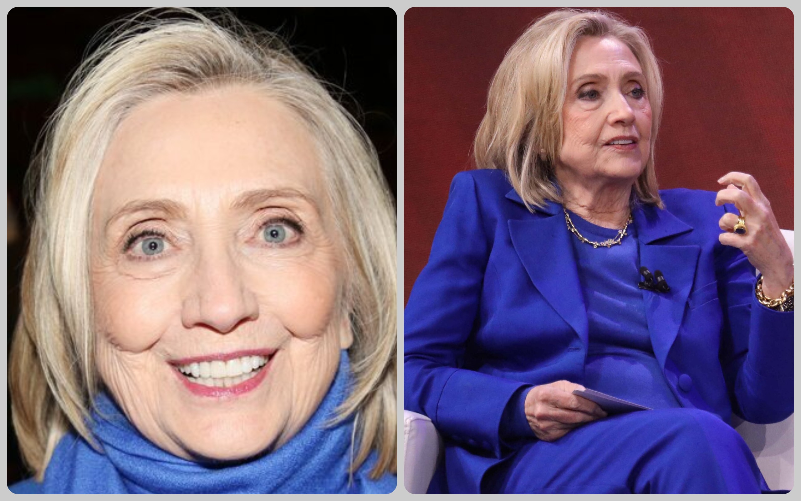 Hillary Clinton Facelift