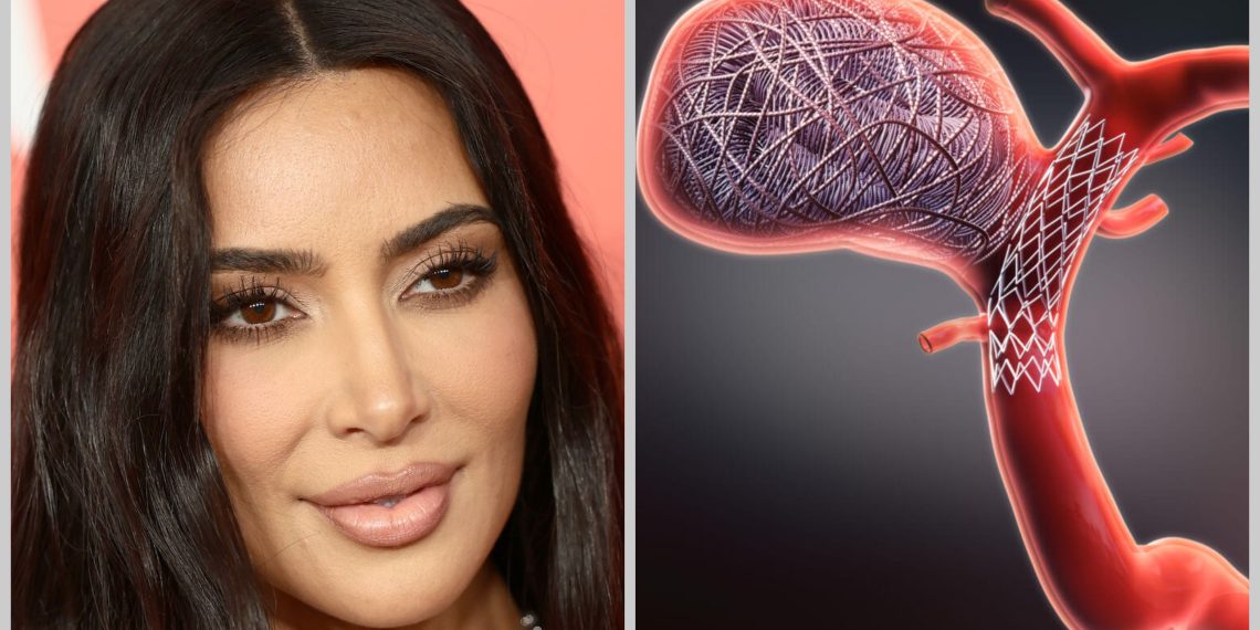Kim Kardashian Brain Aneurysm