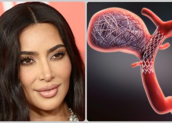 Kim Kardashian Brain Aneurysm