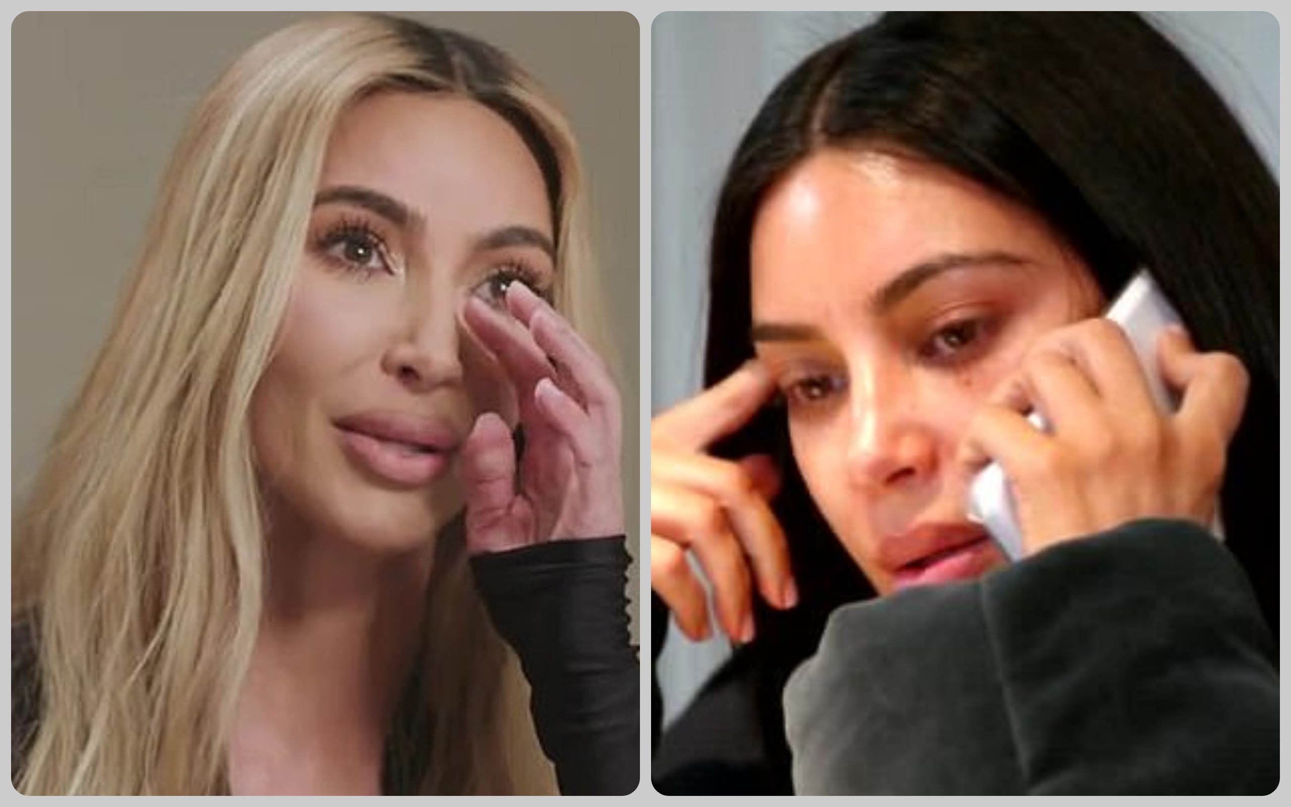Kim Kardashian Brain Aneurysm